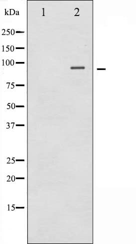 CTNNB1 / Beta Catenin Antibody (phospho-Ser37)