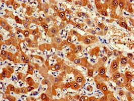 Polyclonal Rabbit anti-Human FDPS Antibody (IHC, WB)