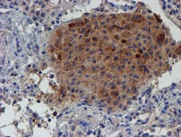 LECT2 Antibody (aa19-151, clone OTI2A11, Carrier-free)