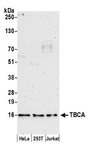 TBCA Antibody (aa58-108)