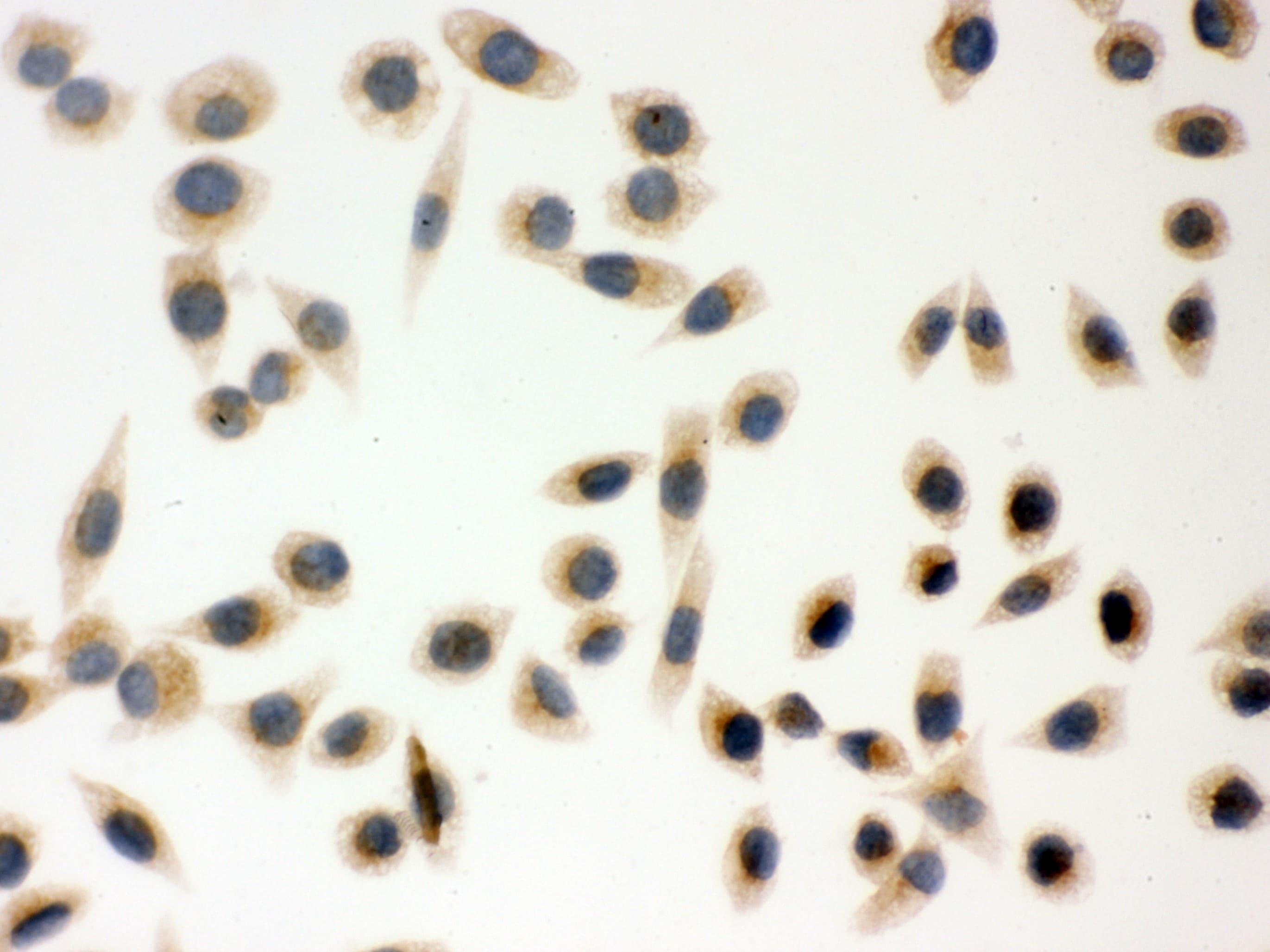PRDX5 / Peroxiredoxin 5 Antibody (aa66-198)