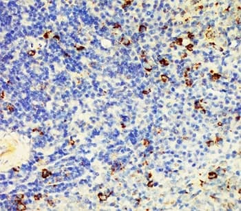 CD95 / FAS Antibody (aa87-109)