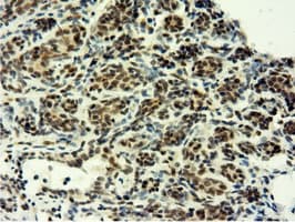 EPM2AIP1 Antibody (clone OTI2G3)
