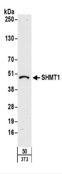 IHC-plus™ Polyclonal Rabbit anti-Human SHMT / SHMT1 Antibody (aa453-483, IHC, WB)