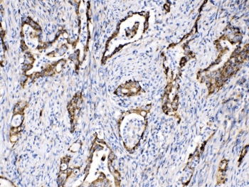 Polyclonal Rabbit anti-Human TECTA Antibody (IHC, WB)