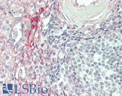 IHC-plus™ CD105 Antibody (Internal)