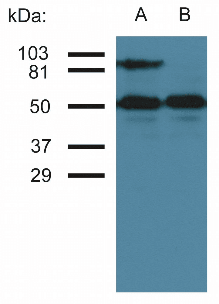 IHC-plus™ ICAM-1 / CD54 Antibody (clone MEM-111)