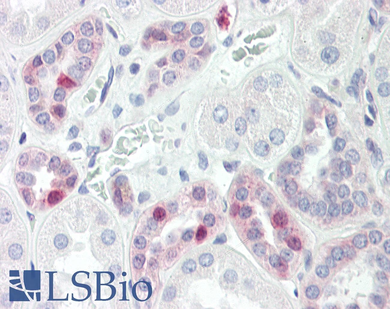 IHC-plus™ Polyclonal Rabbit anti-Human JAKMIP2 Antibody (aa761-810, IHC, WB)