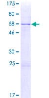 Human SMN2 Protein (Recombinant GST)