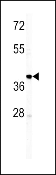 Rabbit Anti-Human IgM Secondary Antibody
