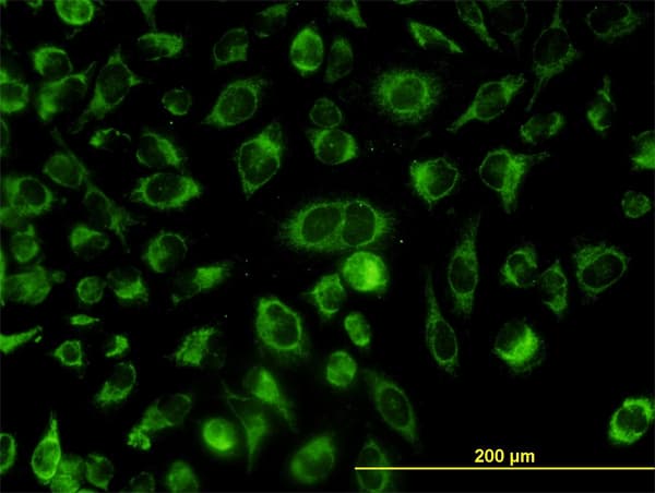 IHC-plus™ Monoclonal Mouse anti-Human ACOT9 Antibody (clone 4E4, IHC, IF, WB)