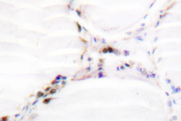 Vitamin D Receptor / VDR Antibody (Asn204)