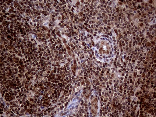 MGMT Antibody (clone OTI6G6)