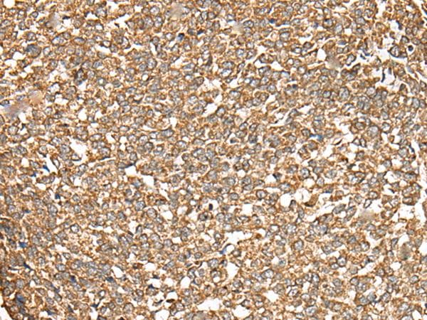 Polyclonal Rabbit anti-Human C5AR1 / CD88 / C5a Receptor Antibody (IHC)