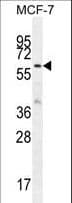 KARS Antibody (aa70-98)