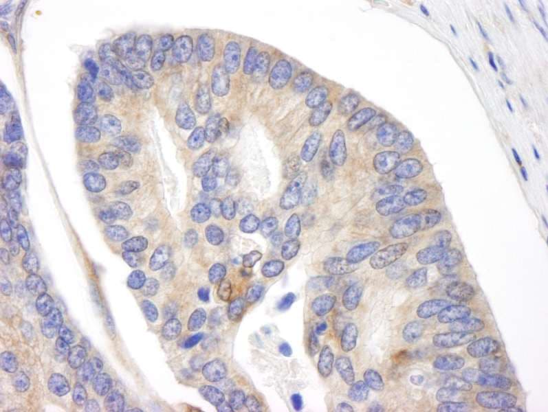 BID Antibody (aa60-120)