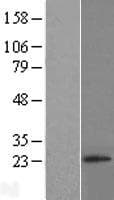 RNF4 Protein (Over-Expression Lysate Myc-DDK (Flag))