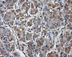 TPMT Antibody (clone OTI4B1)