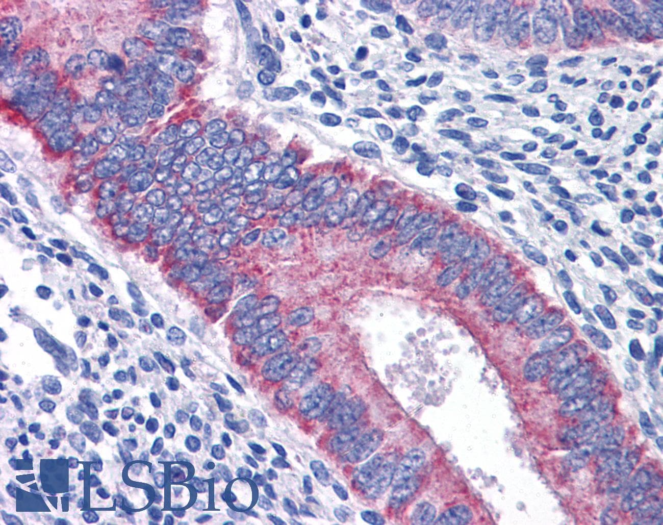 IHC-plus™ BAIAP2L1 Antibody (clone 2A4)
