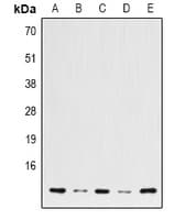 Histone H2B Antibody