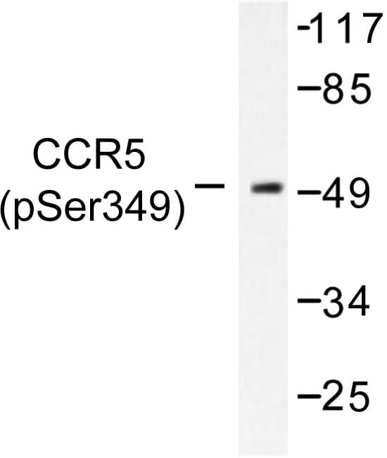 CCR5 Antibody (phospho-Ser349)