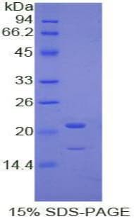 Human PRTN3 / Myeloblastin Protein (Recombinant His)
