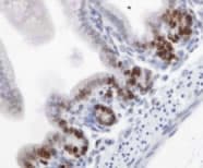 MKI67 / Ki67 Antibody (Internal)
