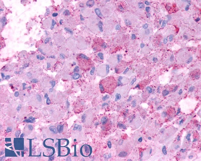 IHC-plus™ Polyclonal Rabbit anti-Human CRHR2 / CRF2 Receptor Antibody (N-Terminus, IHC)