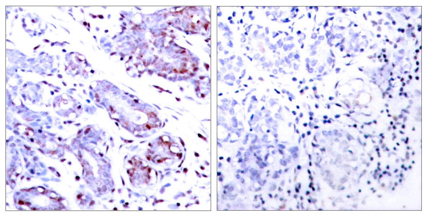 STAT1 Antibody (p701)
