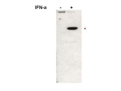 STAT2 Antibody (phospho-Tyr690)