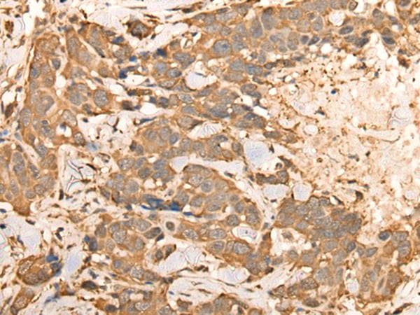 BAIAP2L1 Antibody