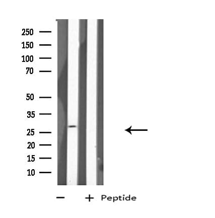 Polyclonal Rabbit anti-Human HLA-DPA1 Antibody (IF, WB)