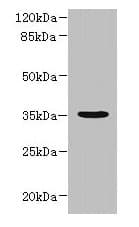 NUBPL Antibody
