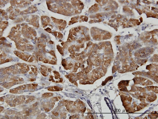 CPB / Carboxypeptidase B Antibody (clone 4D5)