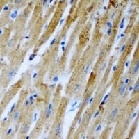 Polyclonal Rabbit anti-Human SLC25A4 / ANT Antibody (IHC, WB)