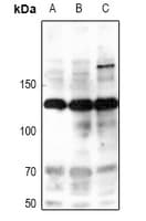 NOS2 / iNOS Antibody