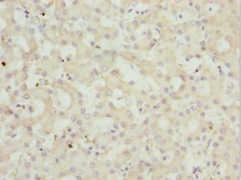 Polyclonal Rabbit anti-Human PEX3 Antibody (IHC, WB)