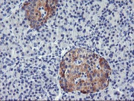 TIMP2 Antibody (clone OTI1D7, Carrier-free)