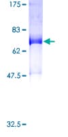 Human SNX16 Protein (Recombinant GST)