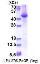 Human Apolipoprotein A-V (Recombinant His)