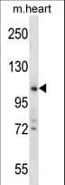Polyclonal Rabbit anti-Human ZCCHC14 Antibody (aa420-449, WB)