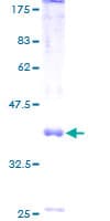 Human HPT / MRS2L Protein (Recombinant GST)