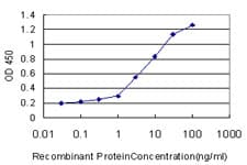 IHC-plus™ FBXO11 Antibody (clone 4C12)