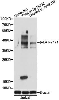 Polyclonal Rabbit anti-Human LAT Antibody (phospho-Tyr171, WB)
