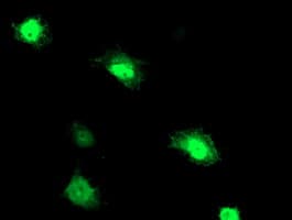 PNMT Antibody (clone OTI2F3)