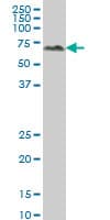 ALPPL2 Antibody (clone 2B3)