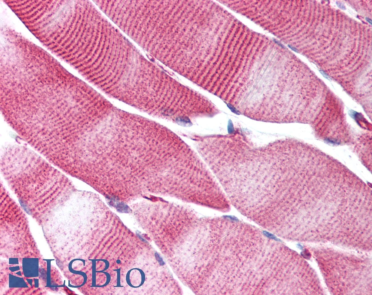 IHC-plus™ GOK / STIM1 Antibody
