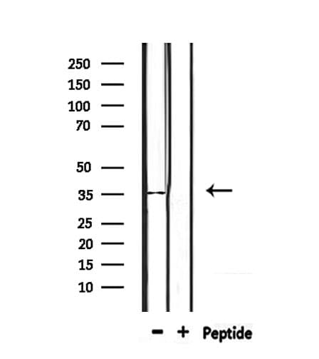 OR4D2 Antibody