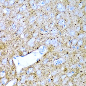 Polyclonal Rabbit anti-Human Prostaglandin D Synthase Antibody (IHC, WB)