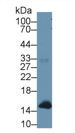 Hemoglobin Antibody